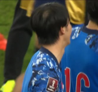 三笘薫の後頭部＆頭頂部はハゲてない！髪質や髪型・噂の理由等を解説！