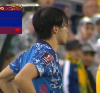 三笘薫はハゲで髪の毛薄い？後頭部・頭頂部や髪型を調査（画像） | きいろピックアップ